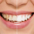 预防牙齿污渍的5种方法