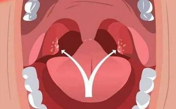 ͼƬ