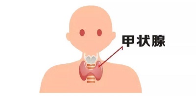 ͼƬ