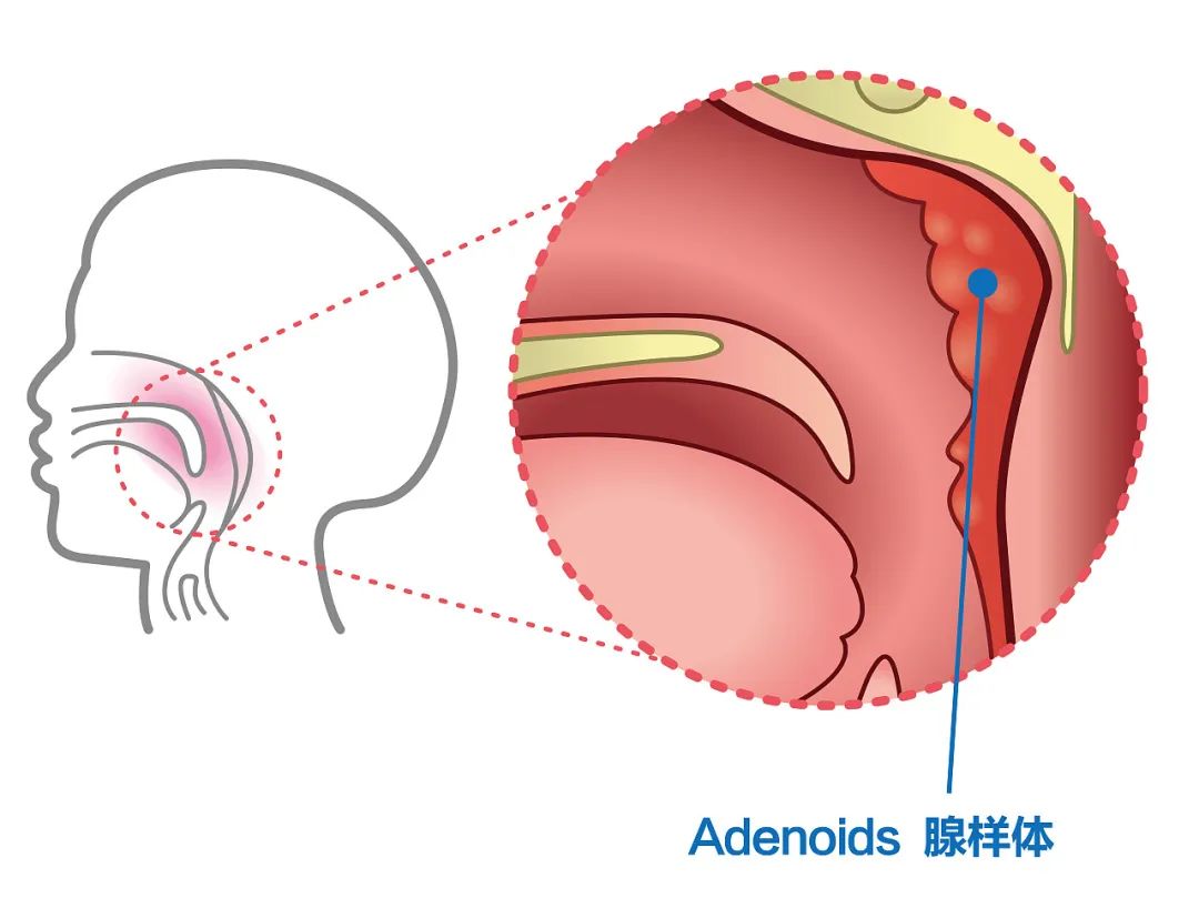 巴氏腺腺口位置示意图图片