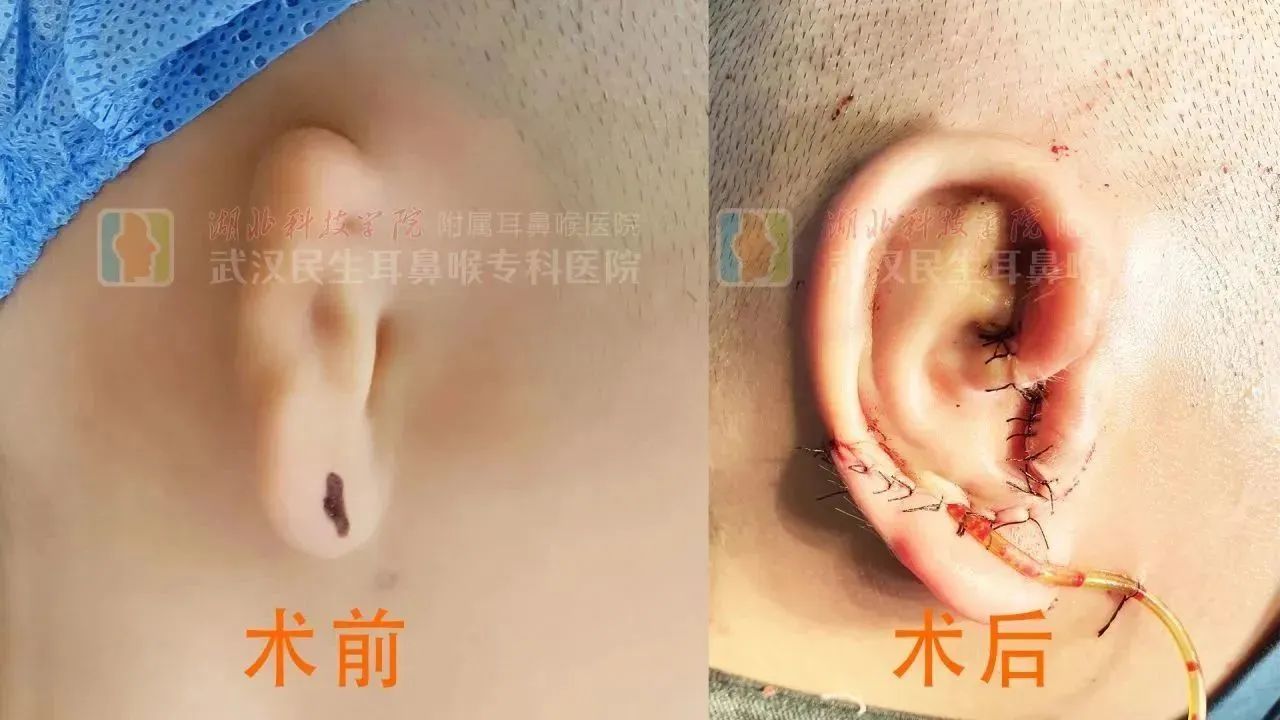 ͼƬ